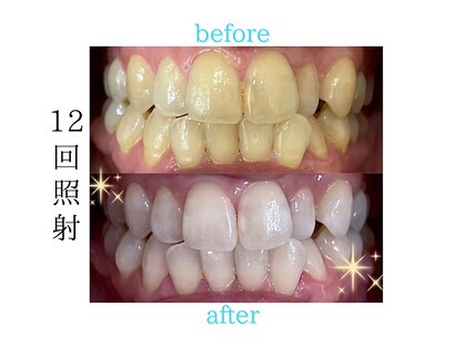 スピカ(spica)の写真