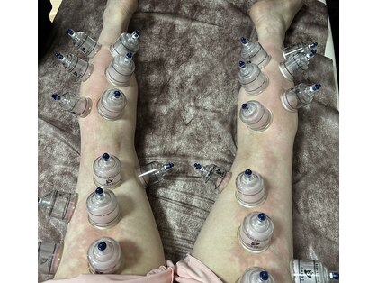 ひめ酵素ワーム(Warm)の写真