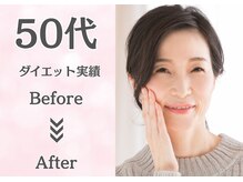 南桜井あおば鍼灸整骨院 春日部/ダイエット実績50代/春日部/痩身