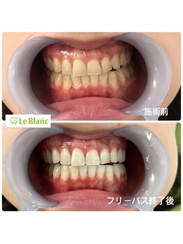 ルブラン 奈良店(Le Blanc)/お得なフリーパスコース