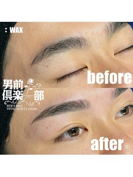 男前倶楽部/脱毛/メンズ脱毛/メンズ専門店