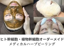 ライリー(Rairy)の雰囲気（天然国産100%×ヒト幹オーダーメイドハーブピーリング）