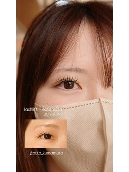 アイラッシュ ティル(eyelash till)/ラッシュリフト×エクステ