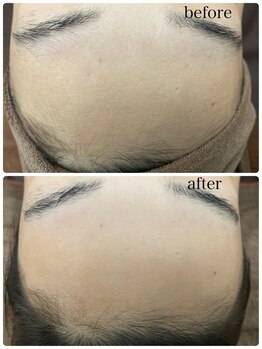 エスポワール ビューティ(Espoir beaute)/フェイシャルWAX