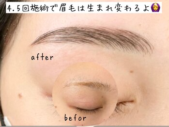 エース ブロウ(ace brow)/５回目で眉の定着を実感できます