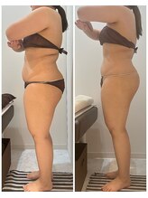 グッドライフエステ/Before＆Afteｒ　キャビ