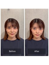 東京G整体/小顔矯正ビフォーアフター◎