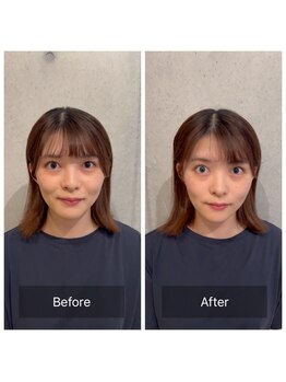 東京G整体/小顔矯正ビフォーアフター◎