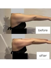 東京デトックス/【B→A】二の腕造形燃焼強炭酸