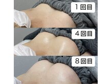 オベリオ(OBERIO)