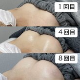 オベリオ(OBERIO)