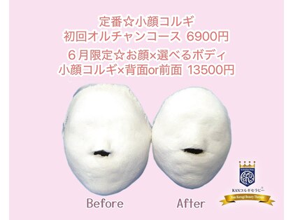 カンコルギセラピー 西新宿店 フレッシュタイム(KAN)の写真