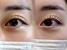 リバレッジ 広尾(Leverage)/まつげパーマビフォーアフター