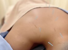 茶ノ木鍼灸整骨院の雰囲気（鍼灸 徒手療法）