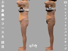 ソウソウビューティー 五反田(Shou Shou Beauty)/ビフォーアフター