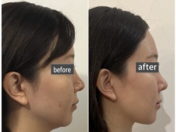 エメリリア 立川店(Aimerlilia)