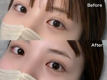ジュベアイラッシュ 別府店(juve. eyelash)/UPforce Lift