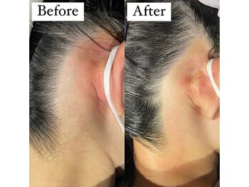 ダウニー(Downy)/20代/女性/介護士