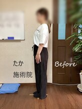 たか施術院/産後の骨盤 関節の痛 30代 初回