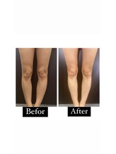 リベル(Liber)/足の軽さ実感、脂肪撃退