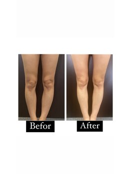 リベル(Liber)/足の軽さ実感、脂肪撃退