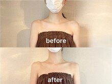 ミヌレ 大阪店(minulle)/首肩回りが一回り小さくなる