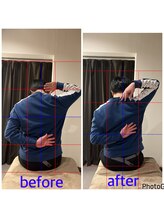 十六夜マッサージ/肩の痛み、動かしにくい方に