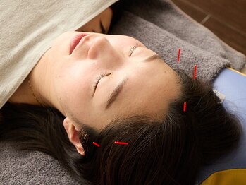 ハマノ鍼灸整骨院/デスクワークの方におすすめ