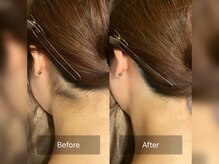 デトックススパボディーラボの雰囲気（部位脱毛で人気[うなじ背中]美肌効果で毛穴や背中ニキビも改善☆）