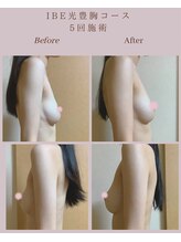 アップオー 小倉店(up・O)/体験者様、施術例