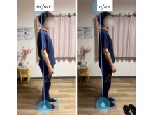 カラダリリース 浜松店/反り腰、胸椎フラットバック改善