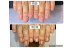 育成ジェルコース　3回目