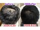 サロンノコ(salon NOKO)の写真/≪メンズ育毛促進におすすめ≫抜け毛/細毛/前髪の後退など髪のお悩みに◎ボリューム&ハリコシのある髪に！