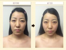 ディグニータココ 自由が丘(DIGNITA coco)/☆before after☆