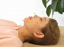 按鍼道/顔はり2