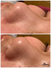 ビューティスペースグリッター(beauty space Glitter)/ハイドロスプラッシュ