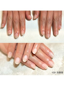 リンク(LINK)/お爪の変化