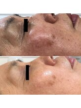 ベルエサロン(Belle Salon)