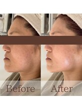 凪眠/小顔リンパフェイシャルの効果31