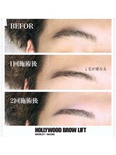 メンズプシュケ(men's PSYCHE)/HOLLYWOOD BROW LIFT