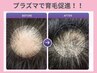 【頭皮環境リセット】毛穴からの刺激で毛根にもう一度活力を!