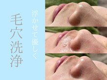 シンディー(CINDY)/肌負担を最小限に抑えた毛穴洗浄