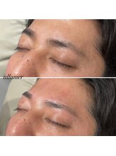 メンズ眉毛サロン　allumer【アリュメ】/眉周りの産毛もスッキリ！