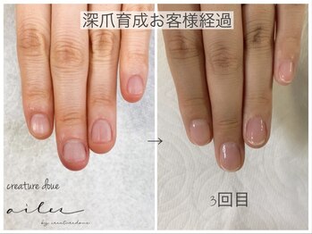 エール バイ クレアチュールドゥエ(ailes by creaturedoue)/カウンセリングを重視しています