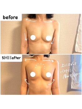 つばききよら/４０代で高さ、ハリUP！４回目☆