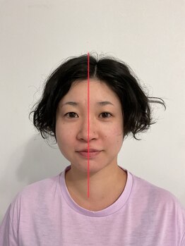 オスベル(OSBELLE)/左側のみ小顔の施術