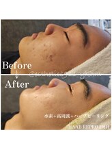 エステティックス ナインワンワン 横浜(Esthetics911) /フェイシャル1回施術で効果◎