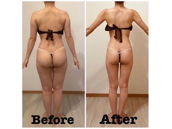 バンヤン(Banyan)/40代のお客様　痩せ美ボディへ！