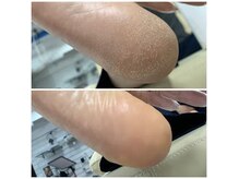 タソニ(DASONI)の雰囲気（1カ月限定！¥22000→¥9800隠し続けたその踵！・人前で出せる足に）