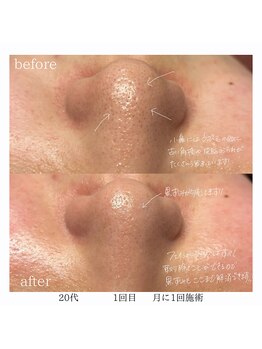 レオン(Leon)/ビフォーアフター